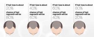 Hair Loss to Regrowth