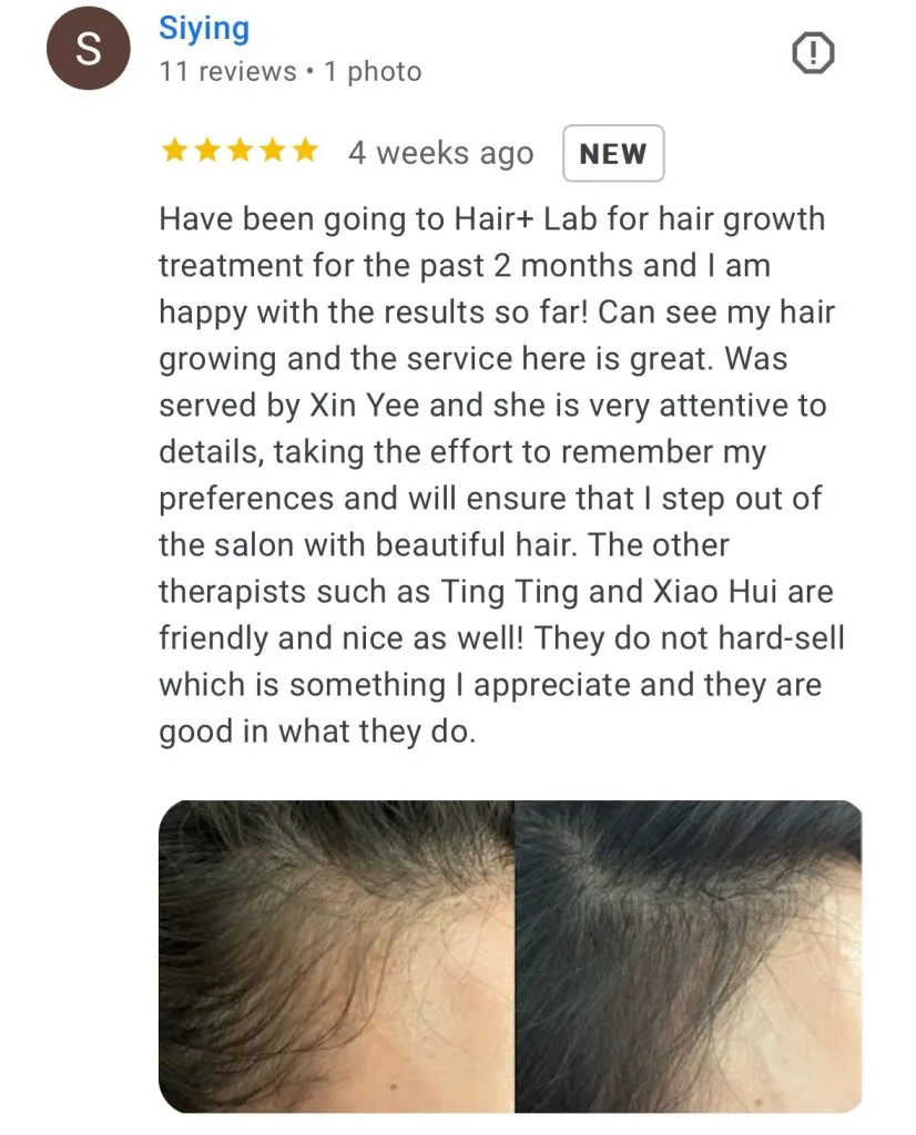 Google Reviews